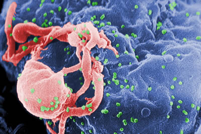 HIV Virus Image FAKE