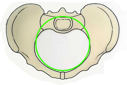 Modern Food Interferes with a Full Pelvic Brim